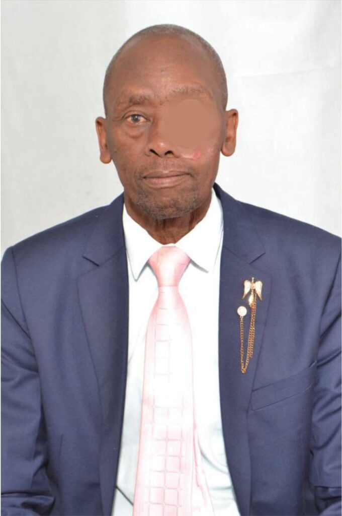 KNH Makes History with Kenya’s First Orbital-Facial Prosthesis Surgery in Public Hospital(Photos) 1 KNH Makes History with Kenya’s First Orbital-Facial Prosthesis Surgery in Public Hospital(Photos)