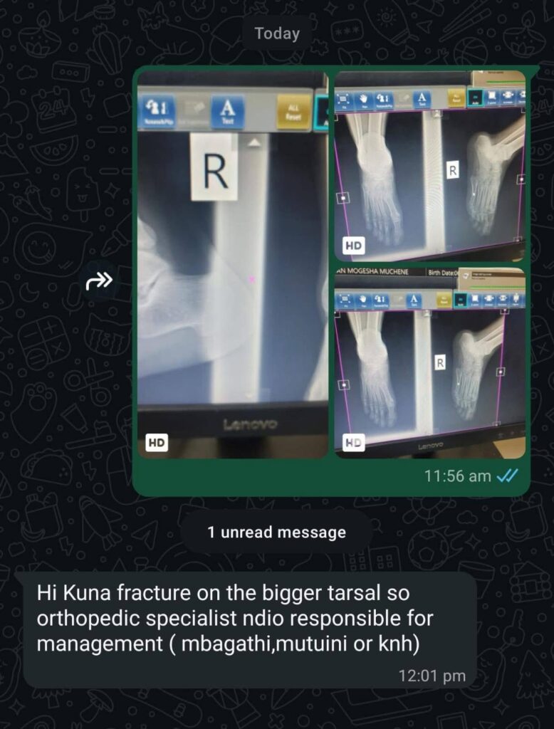 Dagorreti South MP John Kiarie on The Spot After Knocking Down a Boda Boda Rider And Fleeing, Leaving Him With Serious Injuries(Photos)