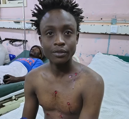 Boda Boda Miraculously Survives After Being Shot 7 Times During Fuel Demos
