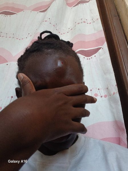Pregnant Woman Cries Out After Being Assaulted by Husband, Flaunts Injuries And Claims He Assaulted Her After Confronting Him Over Infidelity(Photos) Pregnant Woman Cries Out After Being Assaulted by Husband, Flaunts Injuries And Claims He Assaulted Her After Confronting Him Over Infidelity(Photos)
