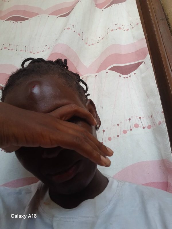 Pregnant Woman Cries Out After Being Assaulted by Husband, Flaunts Injuries And Claims He Assaulted Her After Confronting Him Over Infidelity(Photos)