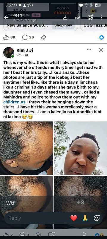 Kalenjin Man Brags About Beating up His Wife And Displays Her Injuries- Claims It’s Part of Their Culture(Photos)