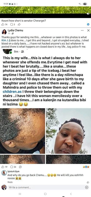 Kalenjin Man Brags About Beating up His Wife And Displays Her Injuries- Claims It’s Part of Their Culture(Photos)