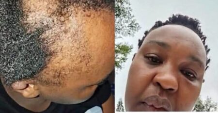 Kalenjin Man Brags About Beating up His Wife And Displays Her Injuries- Claims It’s Part of Their Culture(Photos)