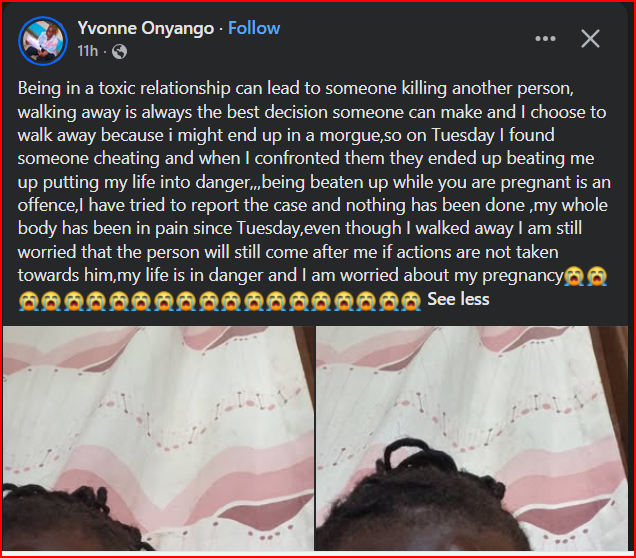 Pregnant Woman Cries Out After Being Assaulted by Husband, Flaunts Injuries And Claims He Assaulted Her After Confronting Him Over Infidelity(Photos)